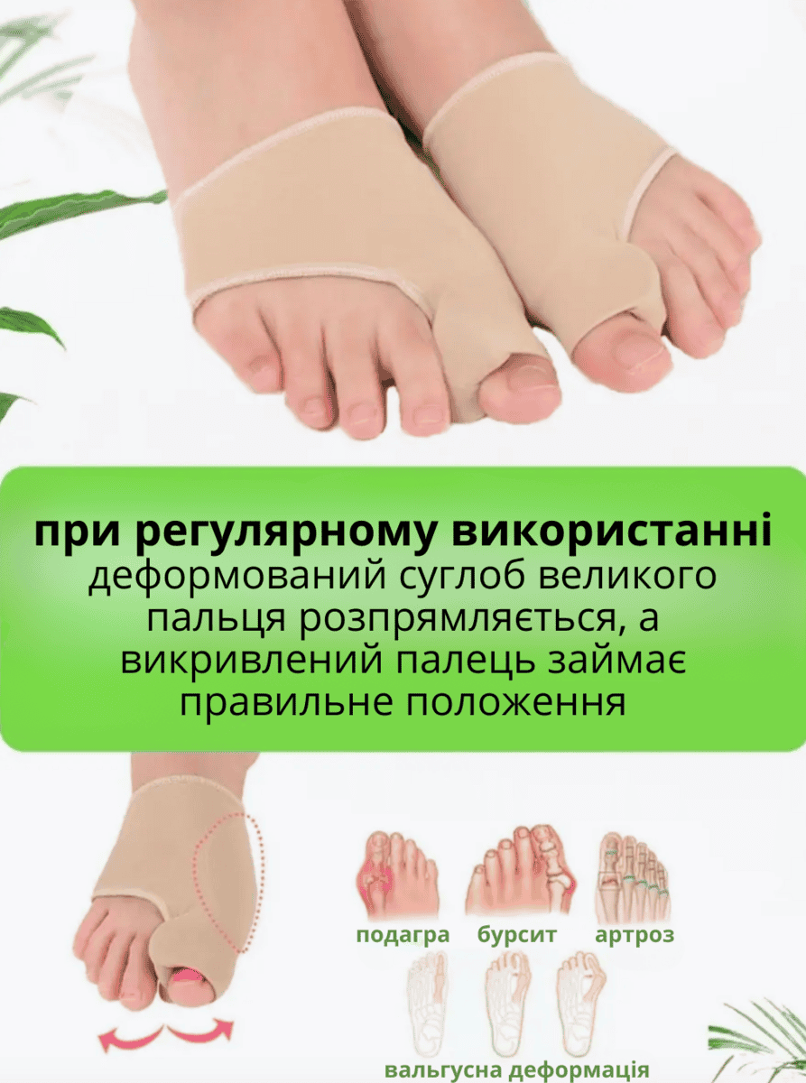 Силіконовий фіксатор для випираючої кісточки великого пальця