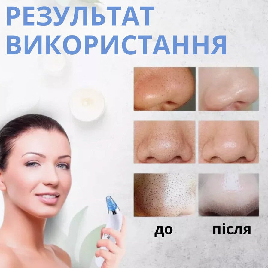 Вакуумний очисник шкіри та пор