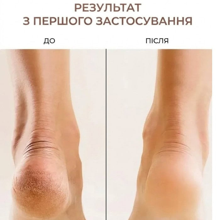 Електрична пемза для ніг пилка для п'яток для педикюру